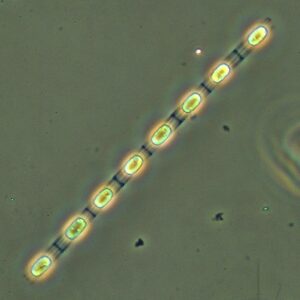 Mikroskopbild på en kiselalg